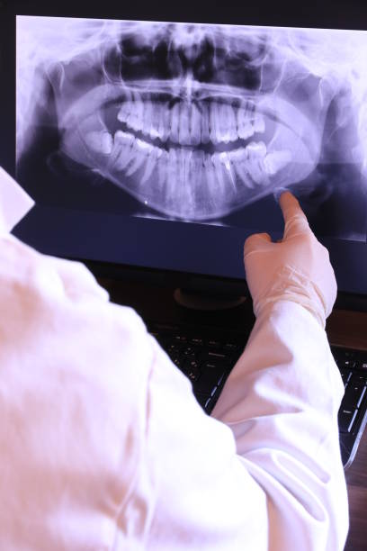 Best Urgent Care for Lost Fillings or Crowns in Linden, AL