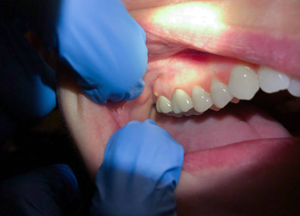 Best After-Hours Dental Trauma Care in Linden, AL