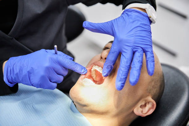 Best Emergency Treatment for Dental Infections or Abscesses in Linden, AL